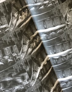 spine MRT